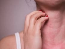 Eczema, Psoriasis & Chronic Allergies