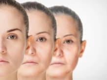 Anti-Aging & Collagen Induction