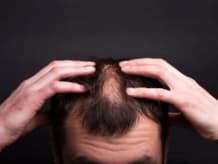 Advanced Trichology & Hair PRP/GFC