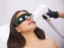 USFDA Laser Hair Reduction